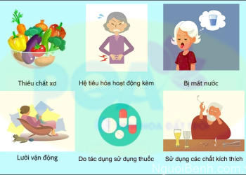 Điện trường cao áp – Phương pháp hỗ trợ điều trị táo bón không cần dùng thuốc cho người cao tuổi